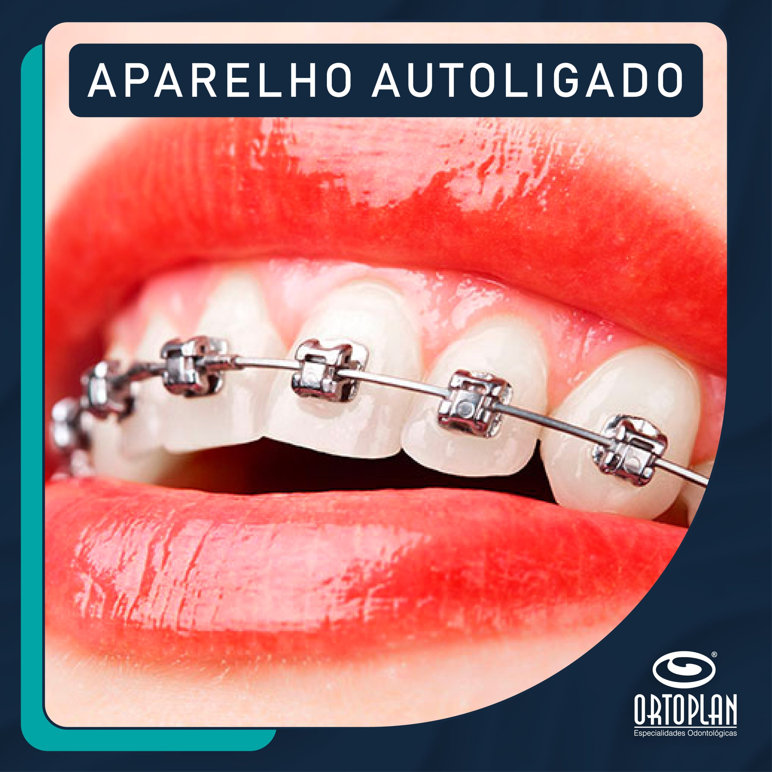 Catalogo ORTOPLAN v2-11